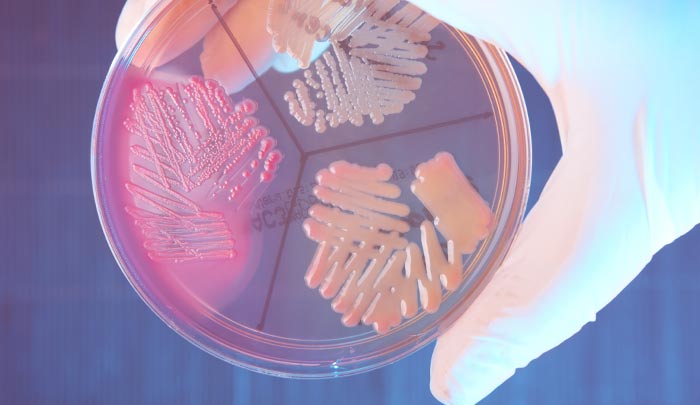 Quelles sont les causes d’une cystite ? 